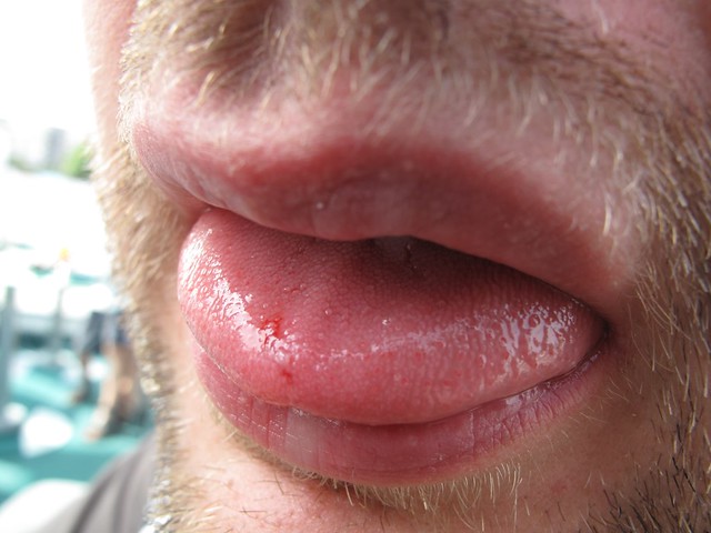 Person biting tongue